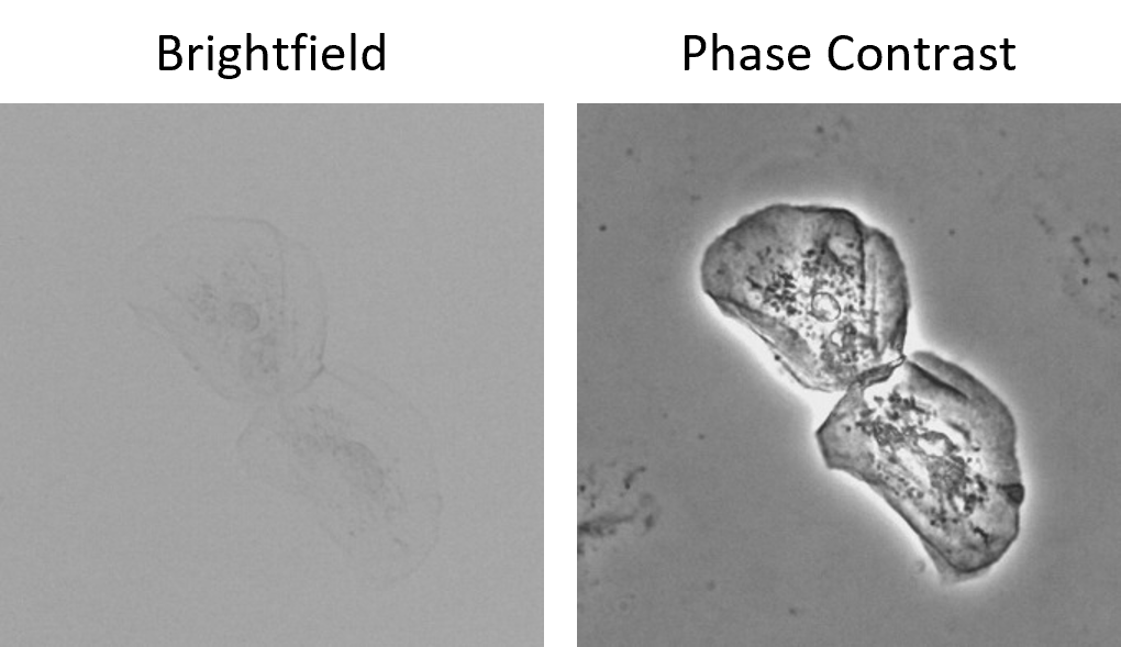 Two microscope images comparing cheek cells under brightfield and phase contrast. The cells are barely visible under brightfield but high contrast under phase contrast.