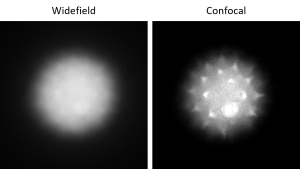 Two images showing a fluorescent image of a pollen grain under widefield and confocal imaging. Widefield image looks like a blurry sphere. Confocal image reveals spikes on the pollen surface.